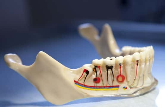 A tooth model infected becomes ‘dead’ and discolors with an illustration of dental hygiene practices.