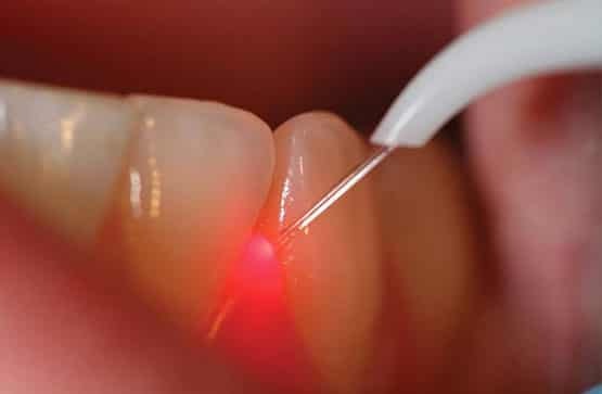 Effective gum treatments include deep cleaning, root planing, antibiotics, and surgical procedures.