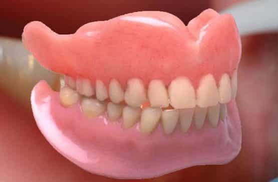 Denture dental treatments involve creating and fitting artificial teeth to replace missing or damaged teeth.