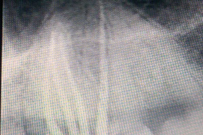 A dental x-ray displays the findings of a dental examination and a single tooth in the oral cavity.