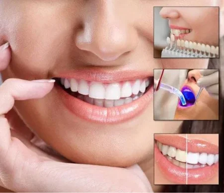 Dental treatment emits a bright blue light that soothes the patient and guarantees a radiant smile