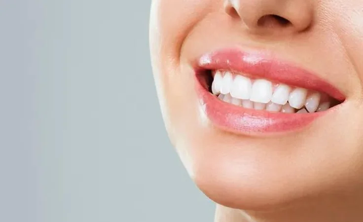 A woman with a captivating smile, her teeth gleaming white, a result of a smile makeover treatment.