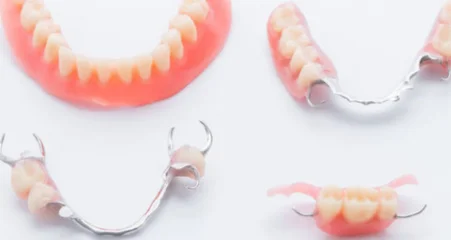 Dental implants and dentures in the various denture treatment options for replacing missing teeth