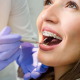 Benefits of Orthodontic Treatment