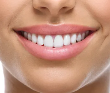 A woman with a bright smile showcasing her white teeth after undergoing smile-correction treatment.